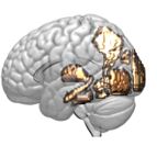 Brain Image