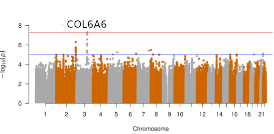 GENEVADER STUDY: Genome-Wide Association Study on Delayed Cerebral ...