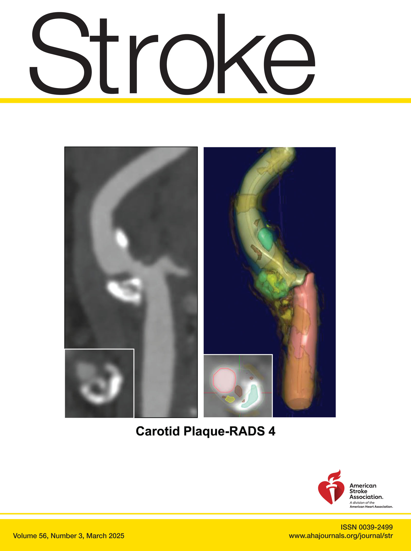 Impact of conventional stroke risk factors on early- and late-onset ...